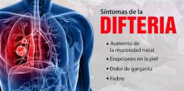 Contagio, causas y prevención de la difteria   